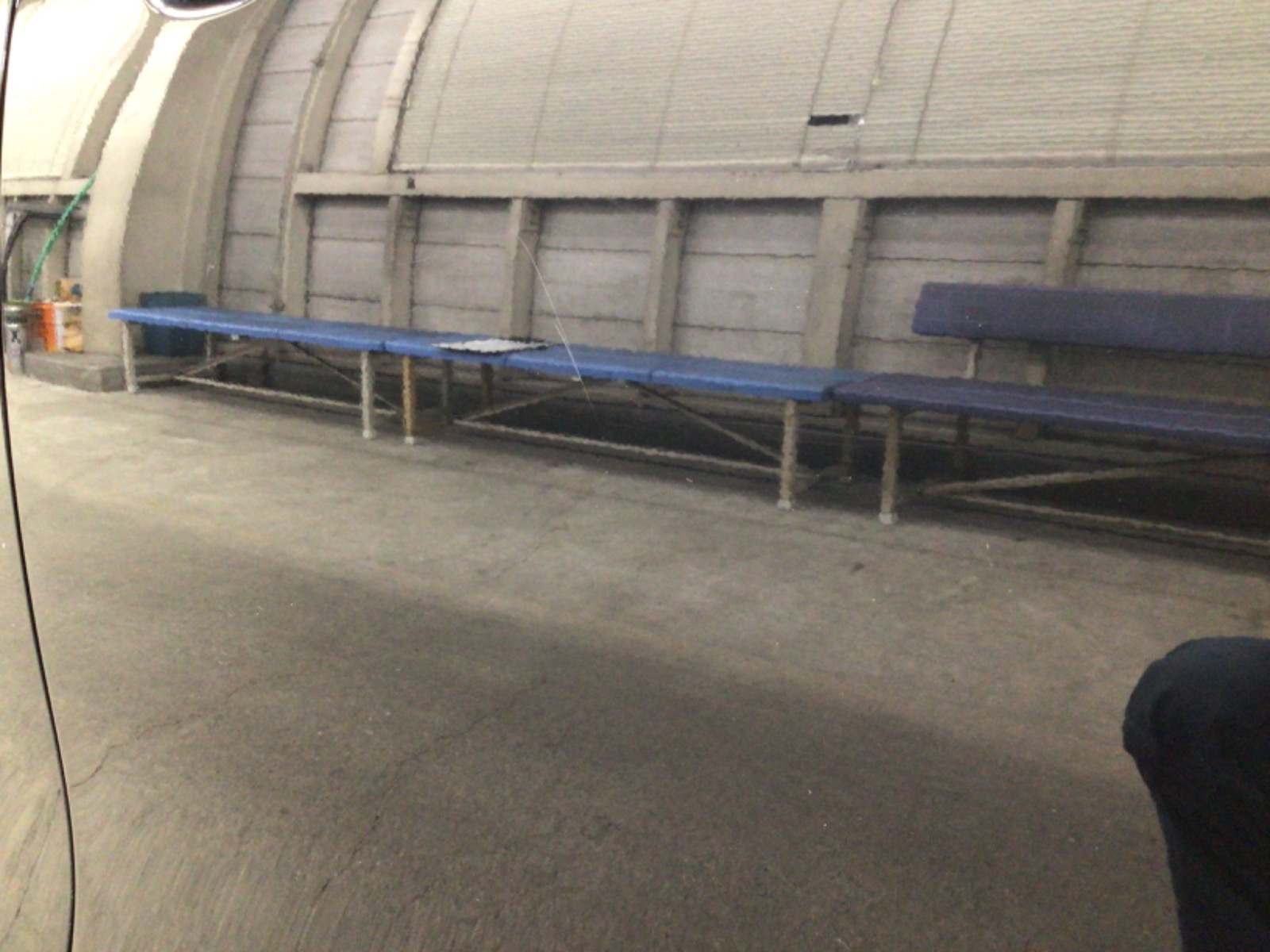 キズ・ヘコミ_24