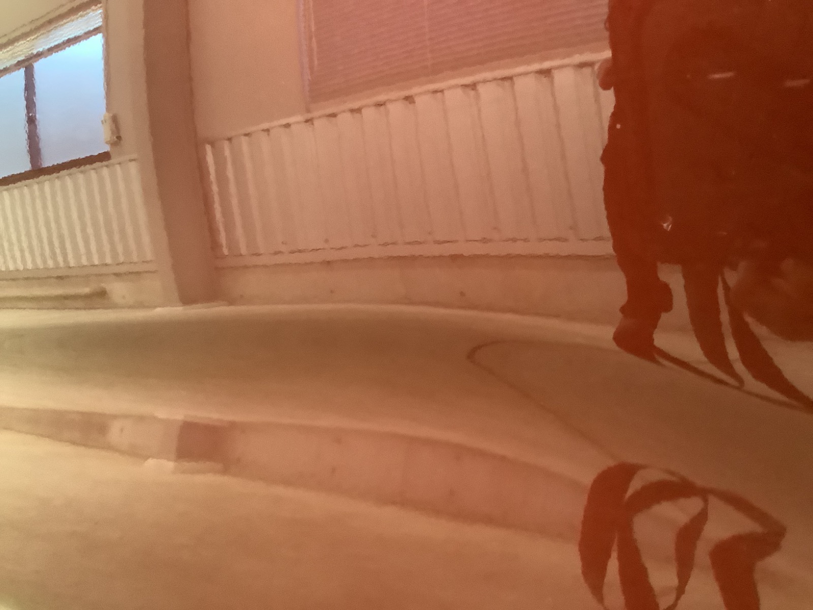 キズ・ヘコミ_24